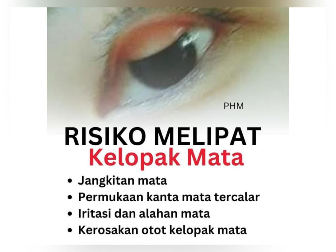 Jangan suka-suka lipat kelopak mata