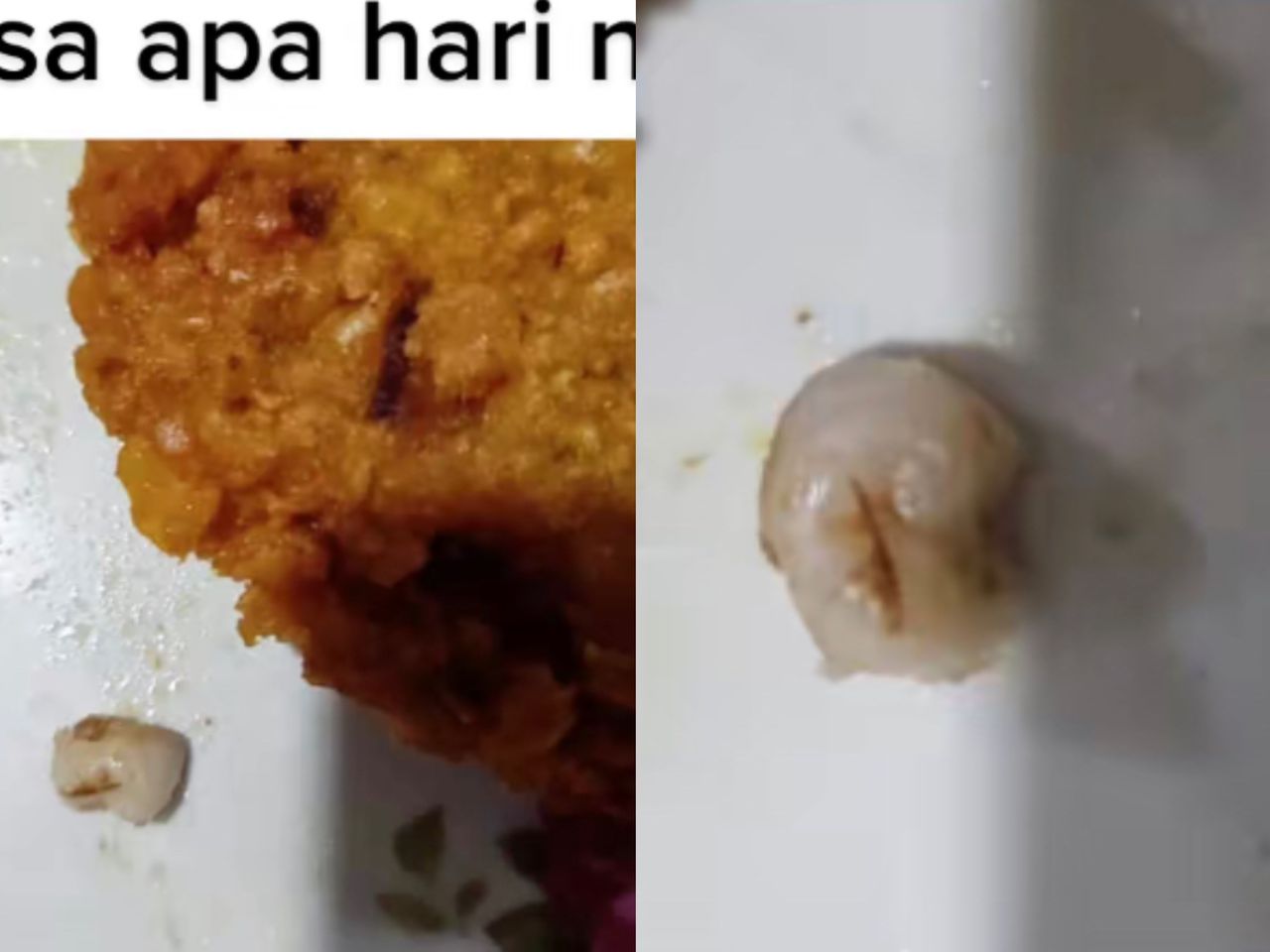 Beli kuih ‘dal’ dapat percuma gigi berlubang