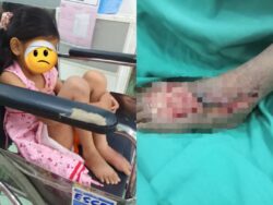 Cederakan anak asuhan, polis panggil kanak-kanak terlibat