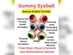 ‘Gummy eye ball’ kenyal, boleh sumbat saluran pernafasan